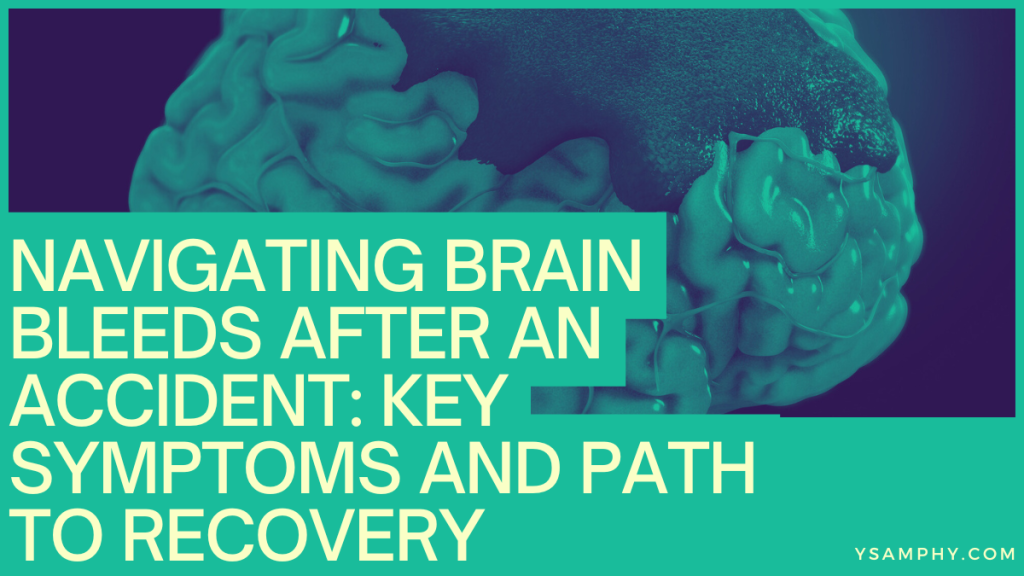 Navigating Brain Bleeds After An Accident: Key Symptoms And Path To Recovery 3 Navigating Brain Bleeds After an Accident: Key Symptoms and Path to Recovery