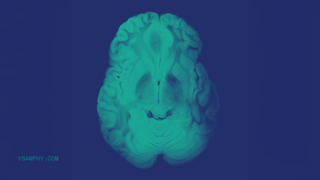 Navigating Brain Bleeds After An Accident: Key Symptoms And Path To Recovery 1 brain